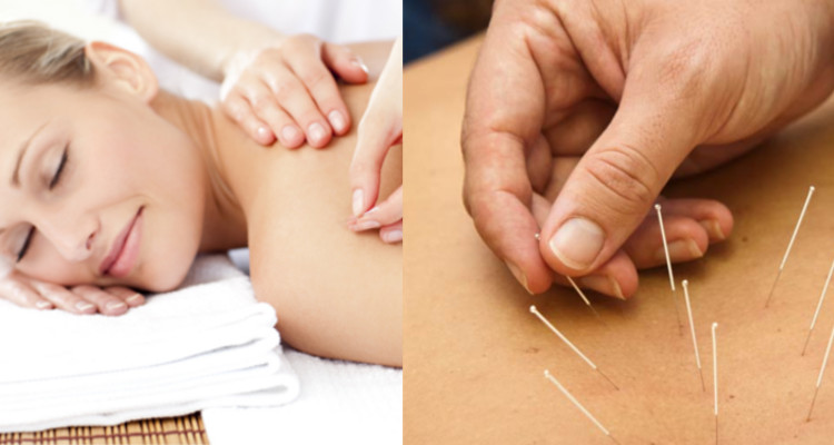 10 Beneficios de la Acupuntura