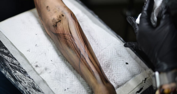 Precio de eliminar un tatuaje