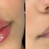 BB lips de labios