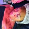 Terapia Facial