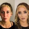Antes / Después Ana
