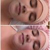 Top face