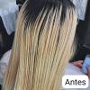 3) Antes
