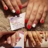 Melovenails