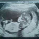 Fran Martínez Seoane